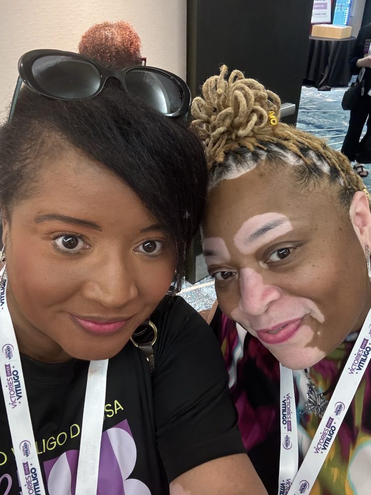 Vitiligo Beautified members connecting at a conference
